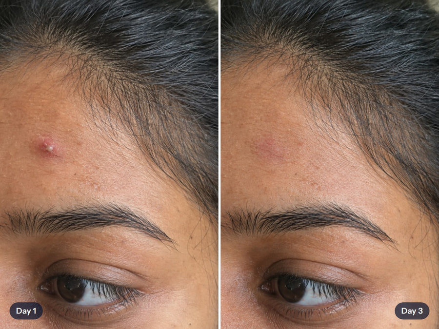 Illustration: spot on day 1 and day 3